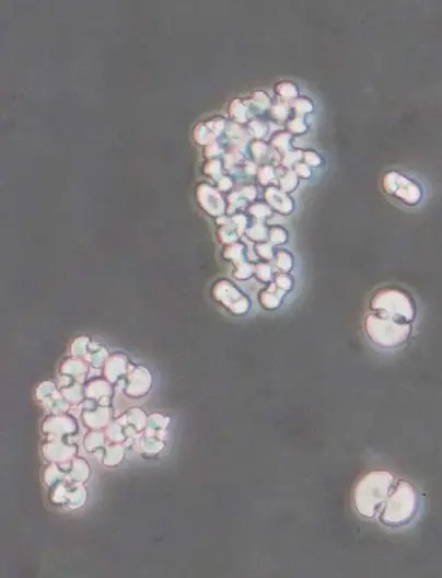 Oxalate de calcium